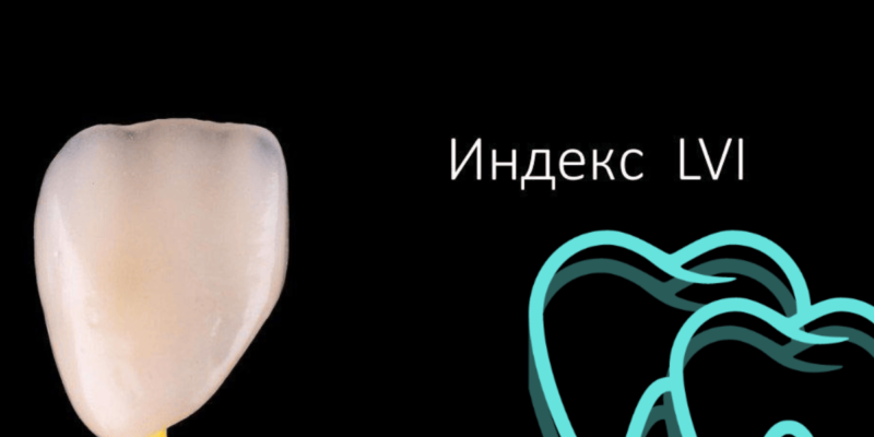 Индекс LVI