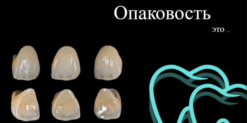 Опаковость в стоматологии